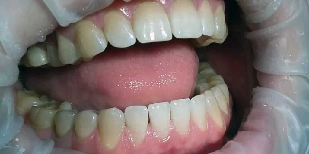 2.2
