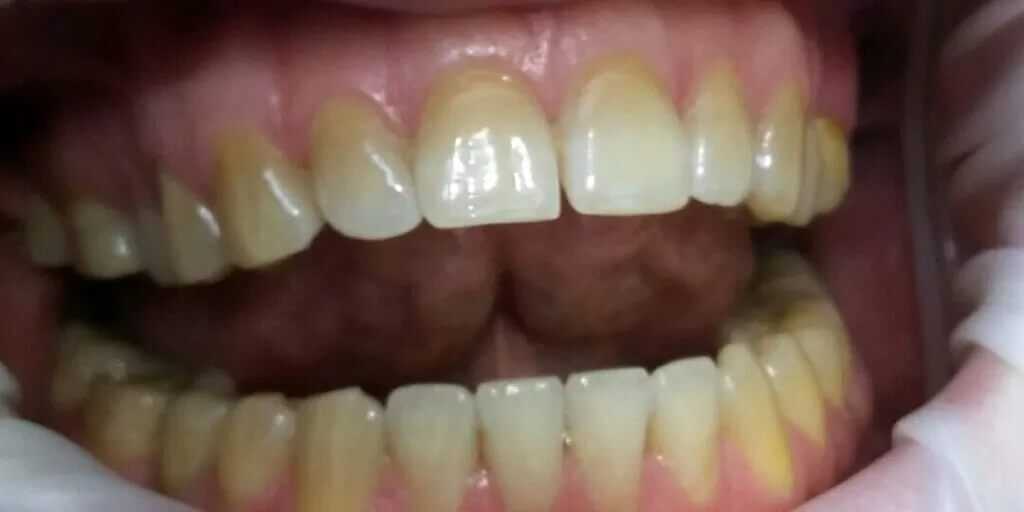 2.2