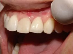 efimov 4