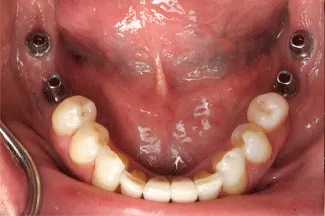 efimov 5