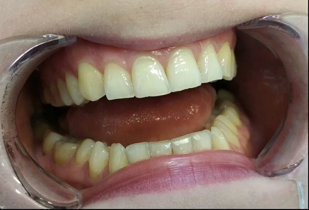image_64834411 2 1024×696