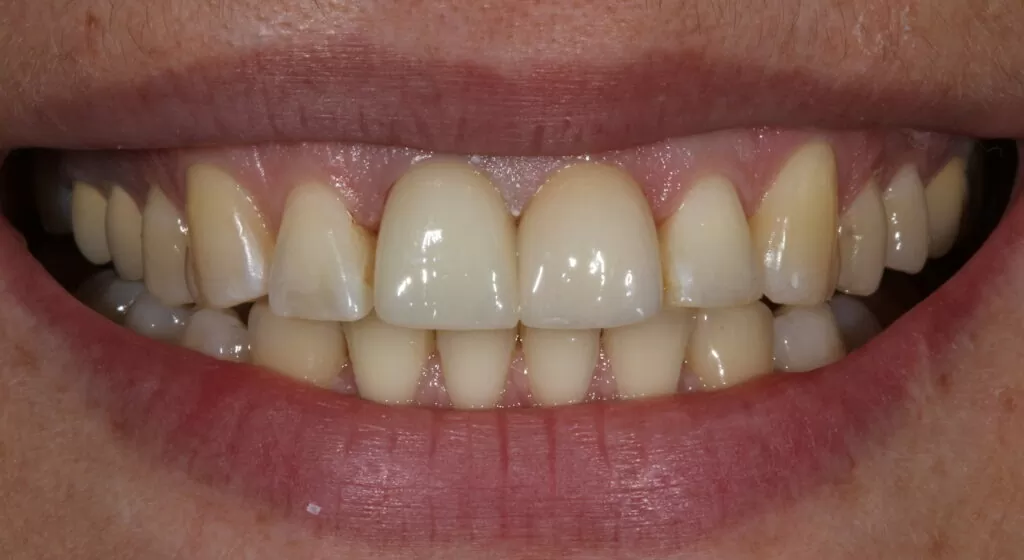 shhirskij1 2 1024×560