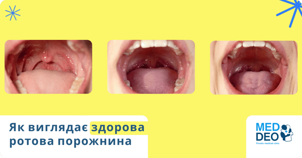 як виглядає здорова ротова порожнина