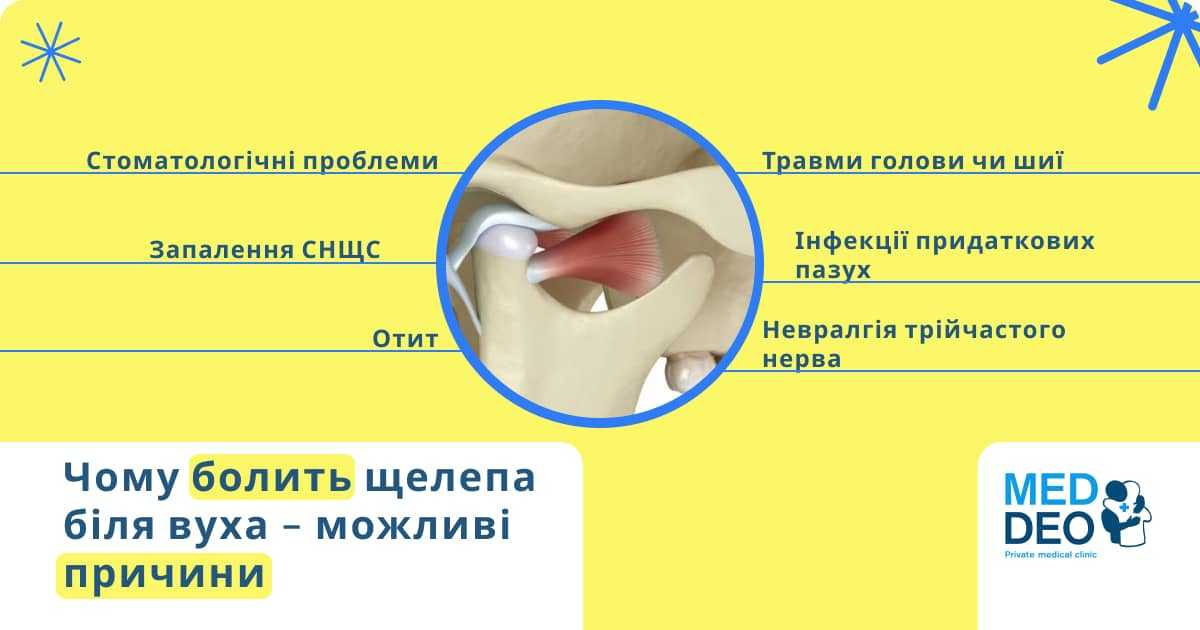 Болить щелепа біля вуха 1 чому болить щелепа біля вуха - можливі причини