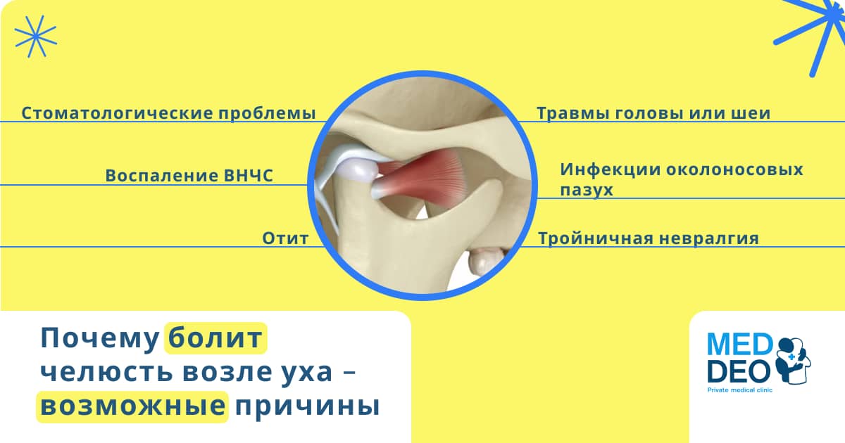 Болит челюсть возле уха bolit schelepa bilya vuha2
