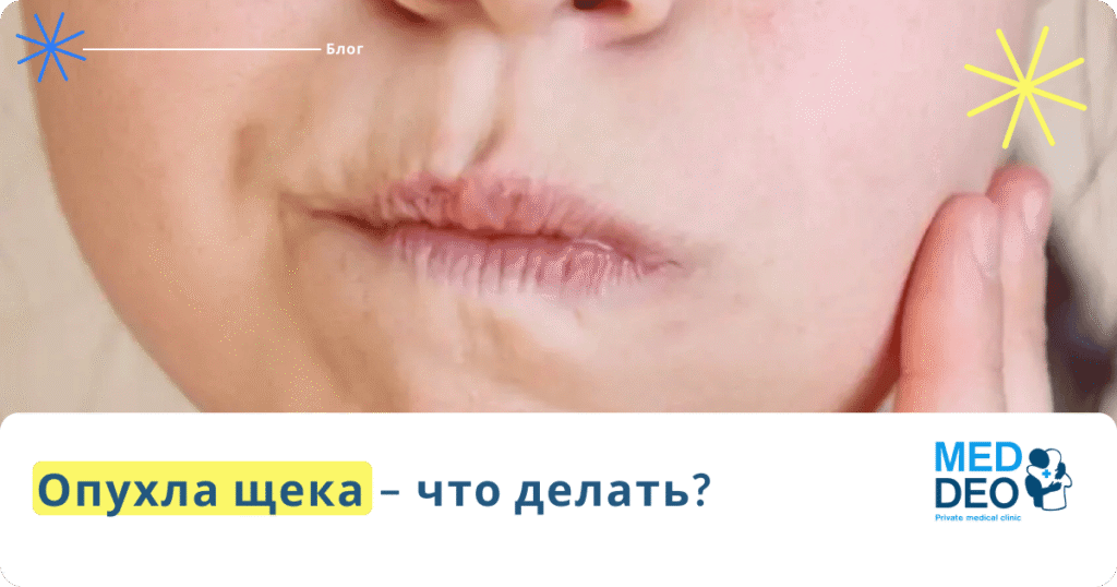 Опухла щека – что делать?