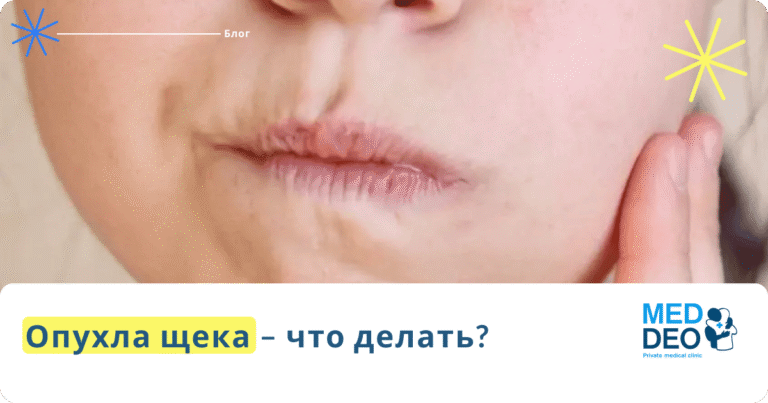 opuhla scheka no zub ne bolit опухла щека но зуб не болит