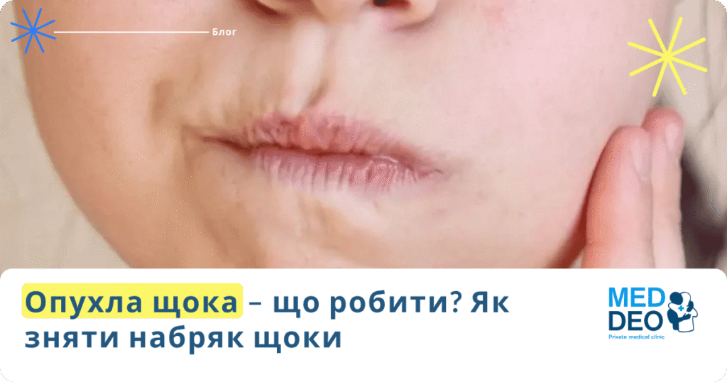 Опухла щока – що робити? Як зняти набряк щоки