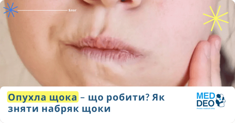 опухла щока від зуба що робити