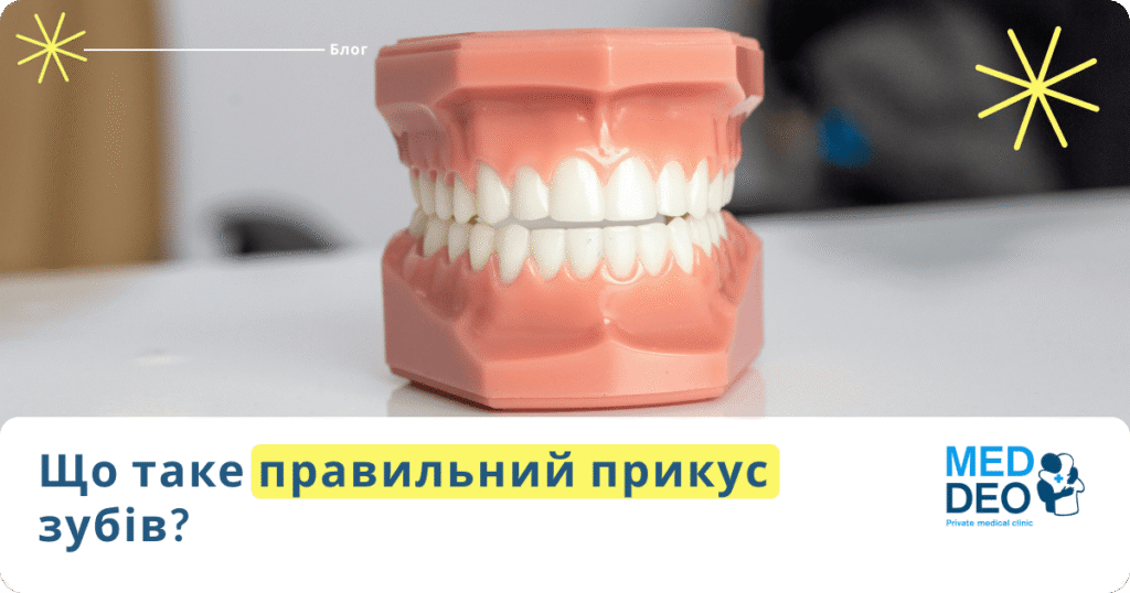 Що таке правильний прикус зубів?