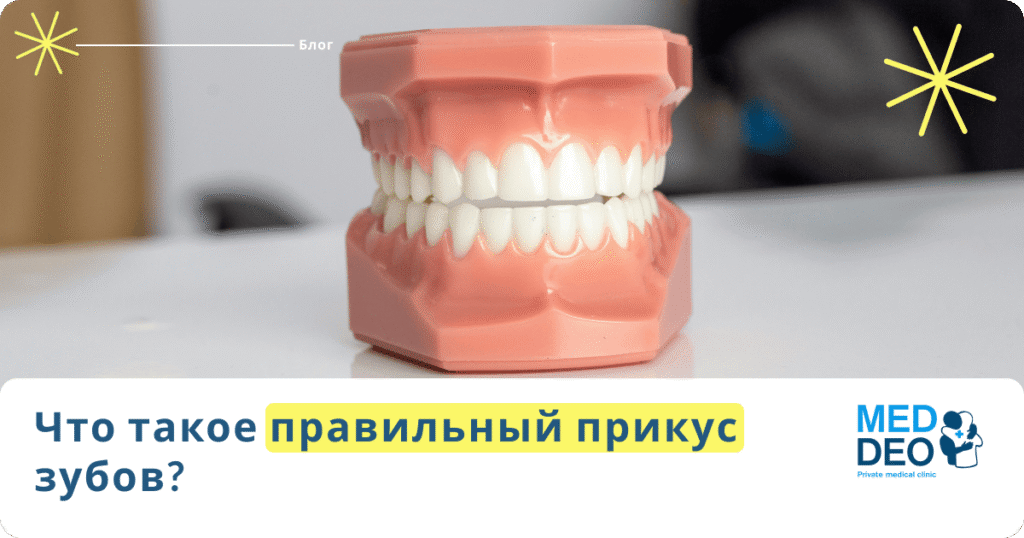 Что такое правильный прикус зубов?