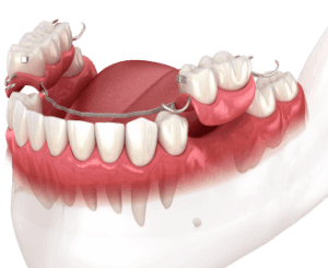 8-protez-300x245