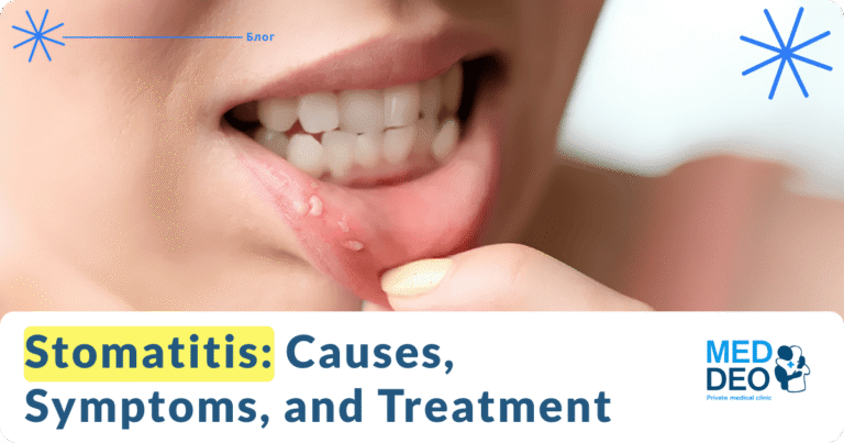 main image_Stomatitis Causes Symptoms and Treatment_EN