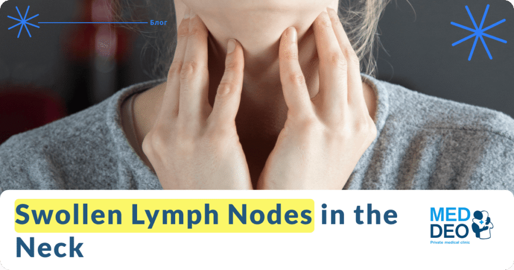 Swollen Lymph Nodes in the Neck: Causes, Symptoms & Treatment