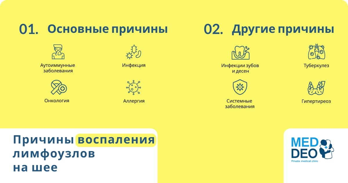 Воспаленные лимфоузлы на шее: причины, симптомы и методы лечения  prichini zapalennya limfovuzliv2