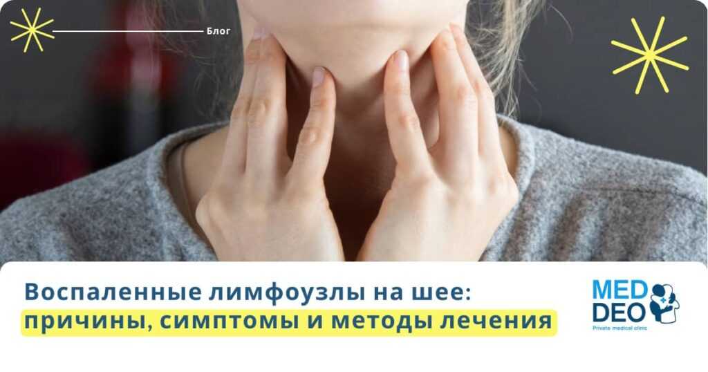 Воспаленные лимфоузлы на шее: причины, симптомы и методы лечения 