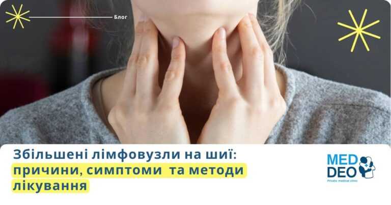 Збільшені лімфовузли на шиї