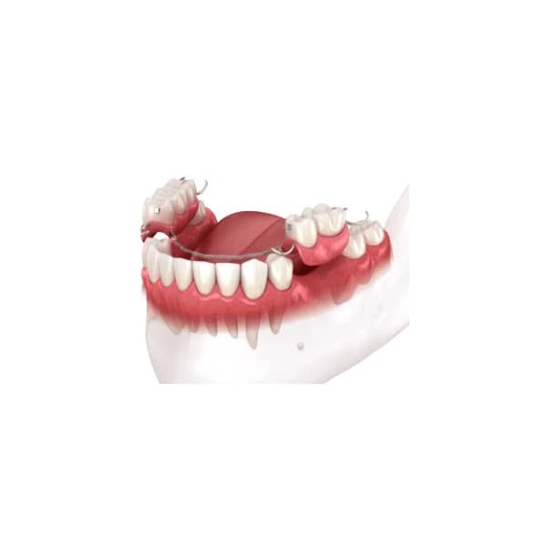 8 protez 600 8 protez 600
