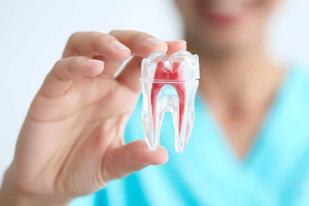 scho take endodontiya що таке ендодонтія