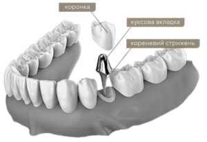 Куксова вкладка