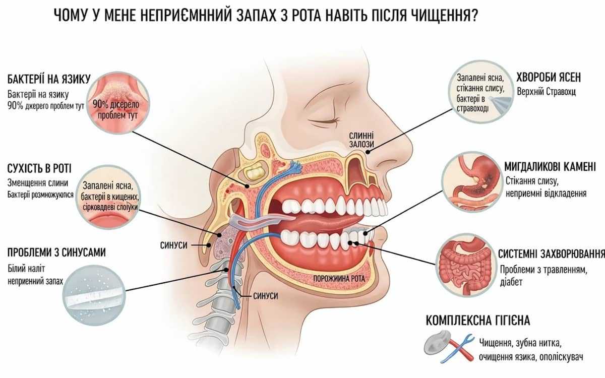 причини неприємного запаху з рота