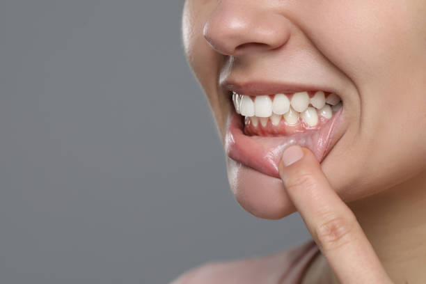 Photo of healthy gums