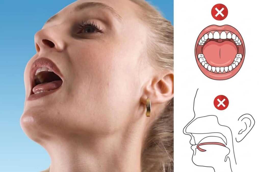 Correct Tongue Position: Effects on Health, Bite, and Facial Aesthetics