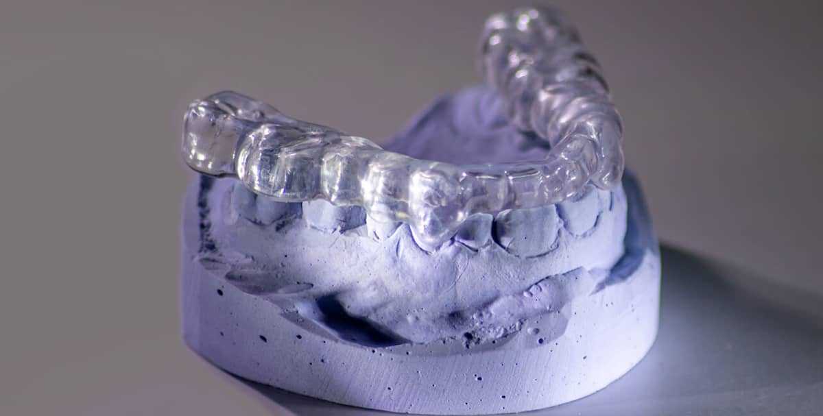 Splint Therapy: What Is a Splint, Who Needs a Joint Mouthguard, and What Affects the Price 1 Splint Therapy